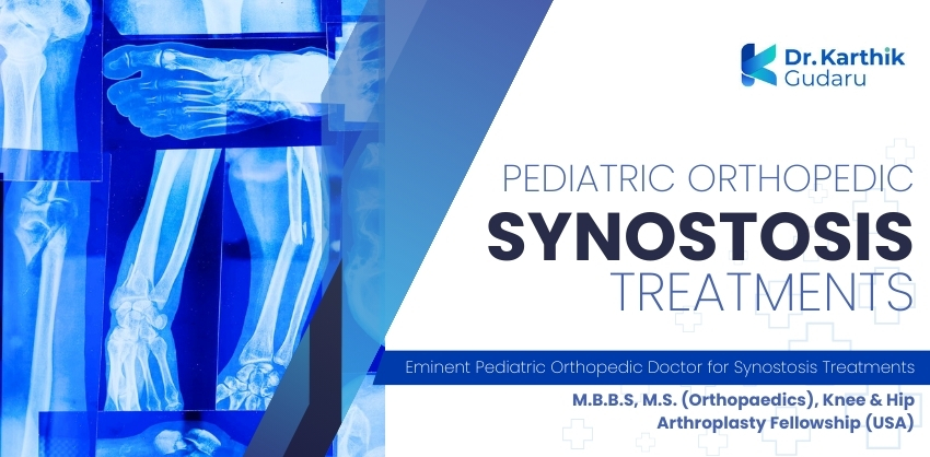 Orthopaedic doctor for Syndactyly Treatment for Children treatment in Telangana Dr Karthik Gudaru